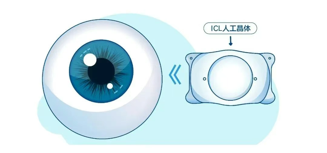 圖片.png 圖片.png